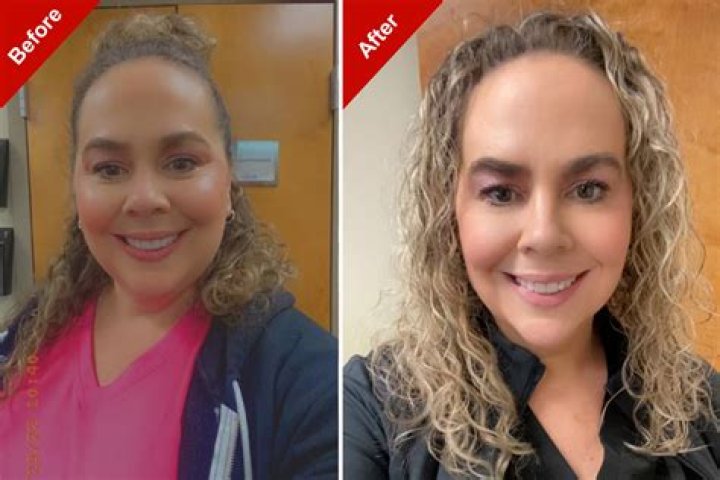 Has Mary Lou Retton Done Weight Loss? Before And After Photo